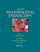 Book cover of: Atlas of Transvaginal Endoscopy. By: Stephan Gordts