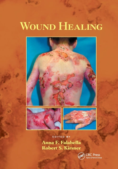 Book cover of: Wound Healing. By: Anna Falabella