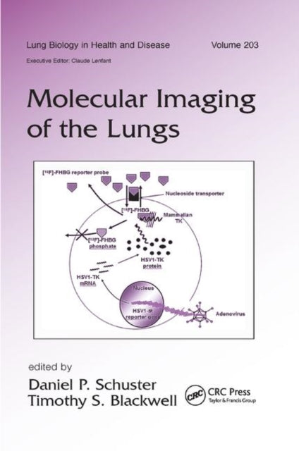 Book cover of: Molecular Imaging of the Lungs. By: Daniel Schuster