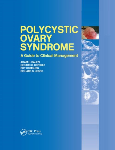Book cover of: Polycystic Ovary Syndrome. By: Adam H. Balen