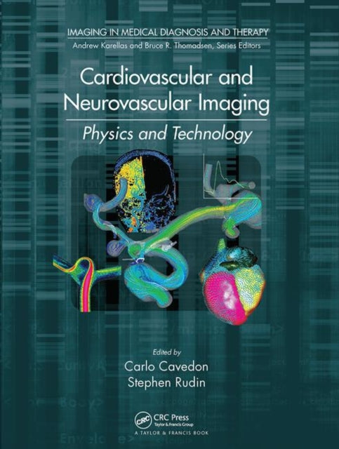Book cover of: Cardiovascular and Neurovascular Imaging. By: Carlo Cavedon