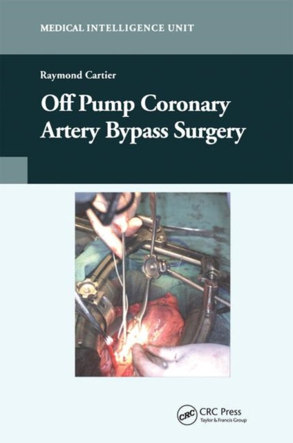 Book cover of: Off-Pump Coronary Artery Bypass Surgery