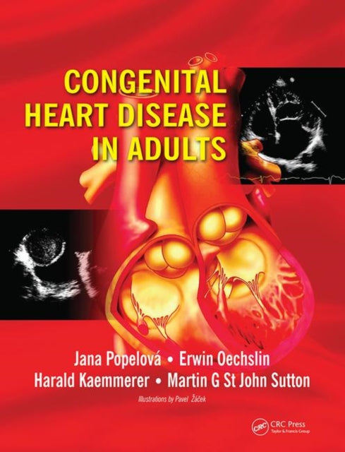 Book cover of: Congenital Heart Disease in Adults. By: Erwin Oechslin