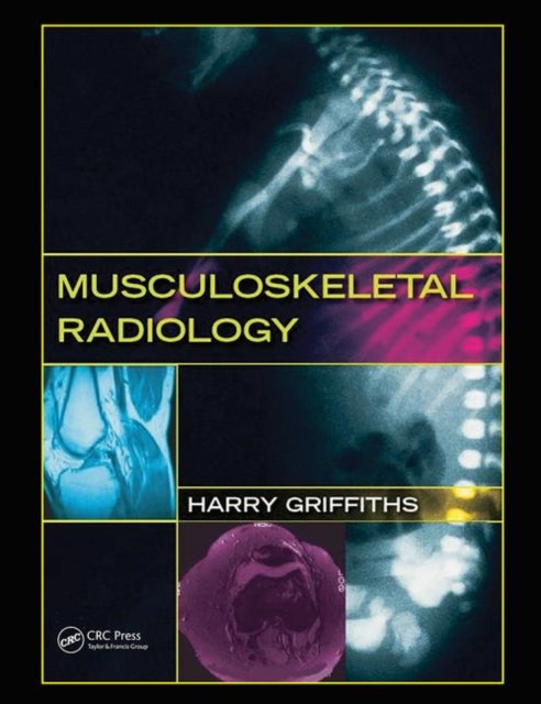Book cover of: Musculoskeletal Radiology. By: Harry J. Griffiths