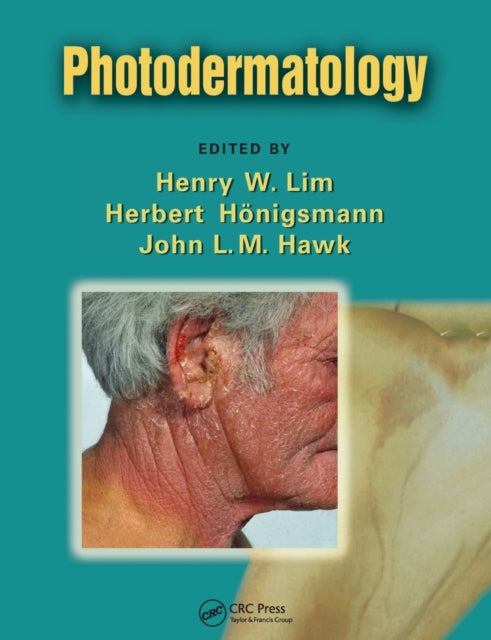 Book cover of: Photodermatology