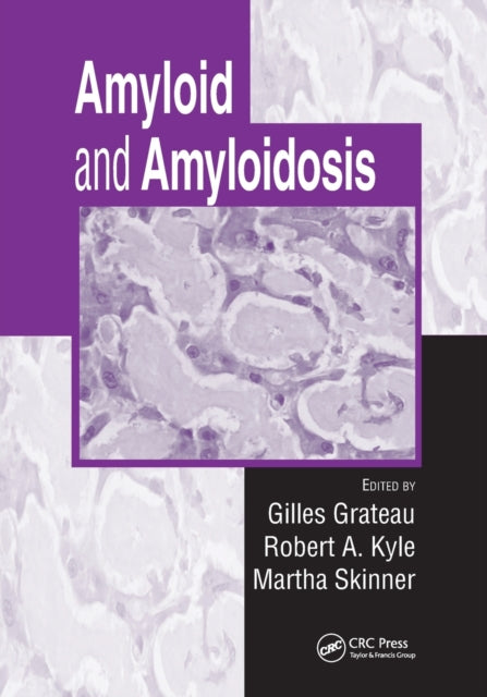 Book cover of: Amyloid and Amyloidosis