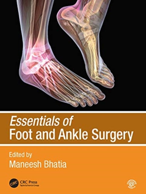 Book cover of: Essentials of Foot and Ankle Surgery. By: Maneesh Bhatia