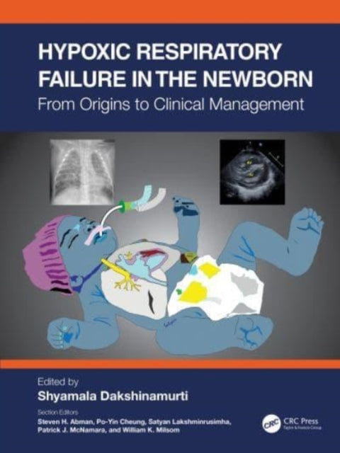 Book cover of: Hypoxic Respiratory Failure in the Newborn. By: Shyamala Dakshinamurti