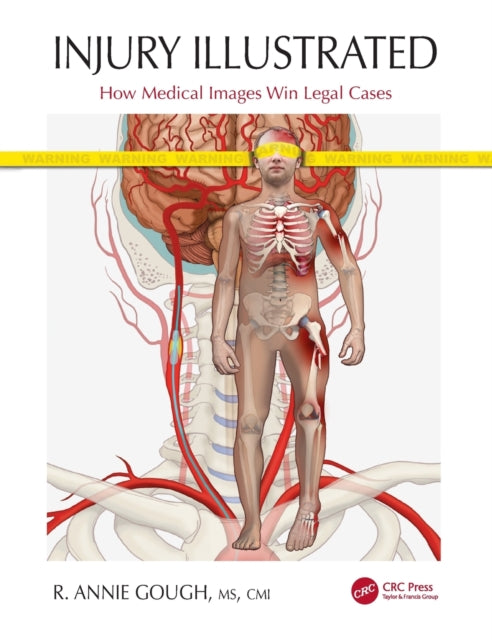 Book cover of: Injury Illustrated. By: R. Annie Gough