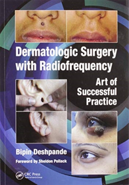 Book cover of: Dermatologic Surgery with Radiofrequency. By: Bipin Deshpande