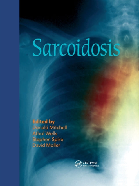 Book cover of: Sarcoidosis. By: Donald G. Mitchell