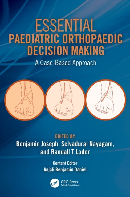 Book cover of: Essential Paediatric Orthopaedic Decision Making. By: Benjamin Joseph
