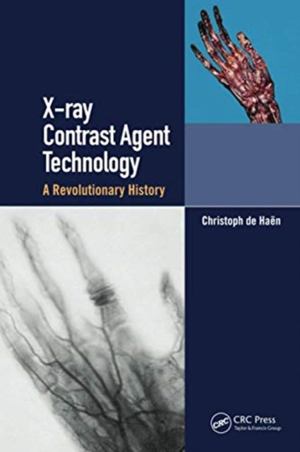 Book cover of: X-ray Contrast Agent Technology