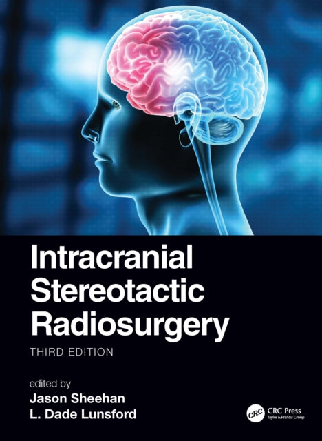 Book cover of: Intracranial Stereotactic Radiosurgery. By: James P. Sheehan
