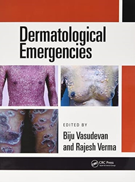 Book cover of: Dermatological Emergencies