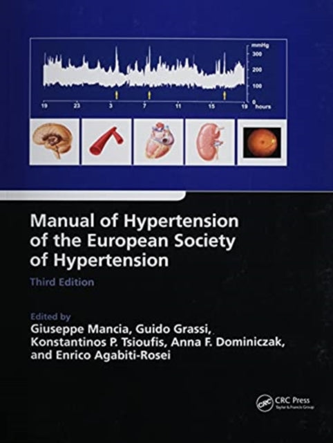 Book cover of: Manual of Hypertension of the European Society of Hypertension, Third Edition. By: Giuseppe Mancia
