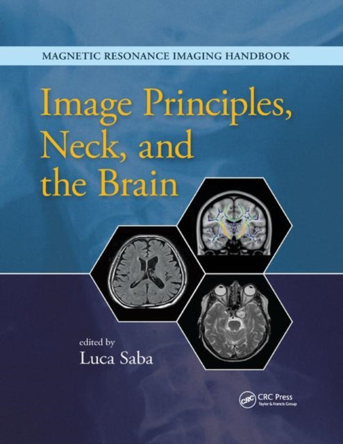 Book cover of: Image Principles, Neck, and the Brain. By: Luca Saba