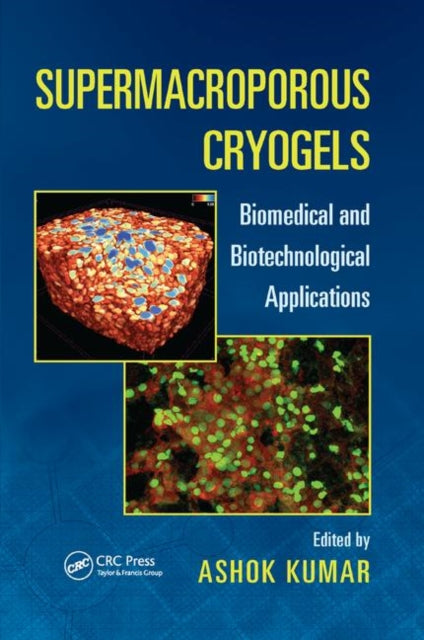 Book cover of: Supermacroporous Cryogels. By: Ashok Kumar