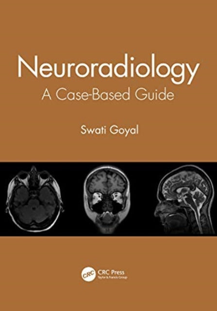 Book cover of: Neuroradiology. By: Swati Goyal