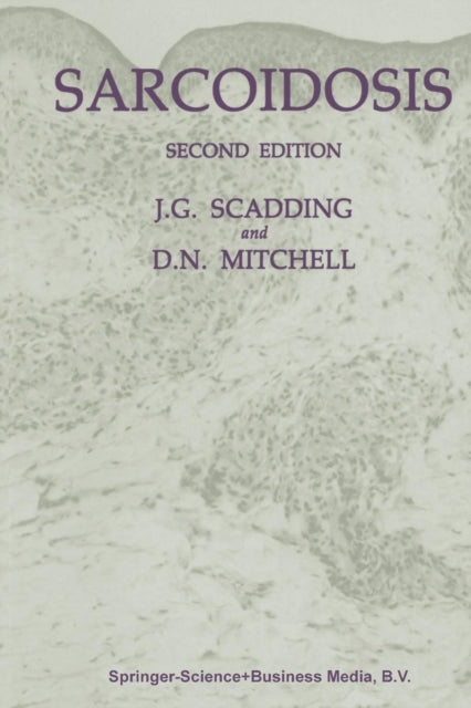 Book cover of: Sarcoidosis