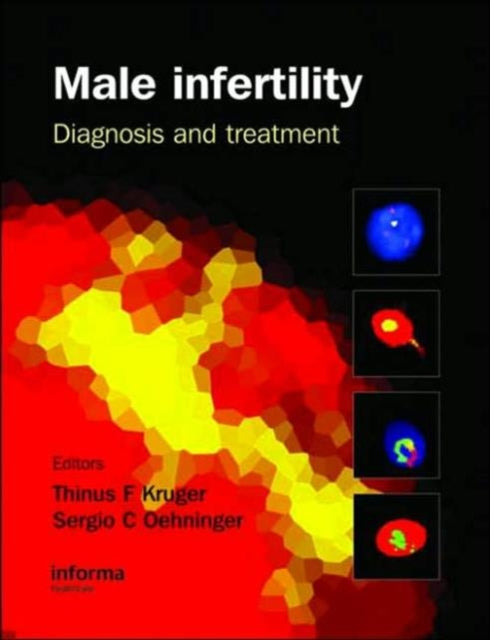Book cover of: Male Infertility