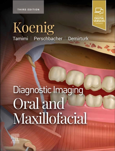 Book cover of: Diagnostic Imaging: Oral and Maxillofacial. By: Lisa J. Koenig