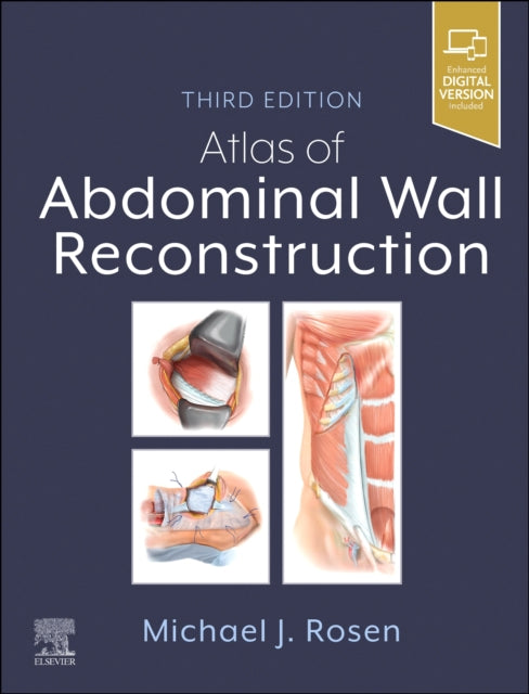 Book cover of: Atlas of Abdominal Wall Reconstruction
