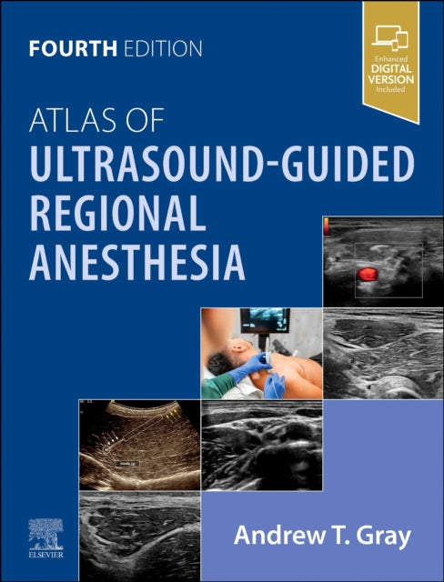 Book cover of: Atlas of Ultrasound-Guided Regional Anesthesia. By: Andrew T. Gray