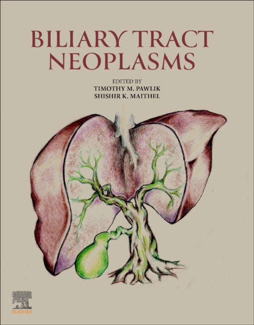 Book cover of: Biliary Tract Neoplasms. By: Timothy M. Pawlik
