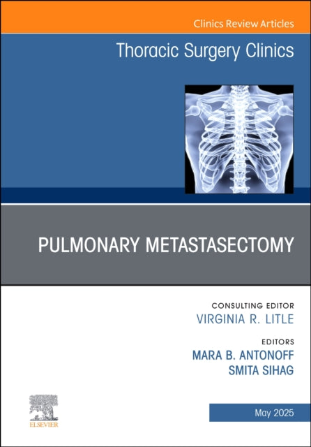 Book cover of: Pulmonary Metastasectomy, An Issue of Thoracic Surgery Clinics