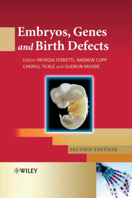 Book cover of: Embryos, Genes and Birth Defects. By: Patrizia Ferretti