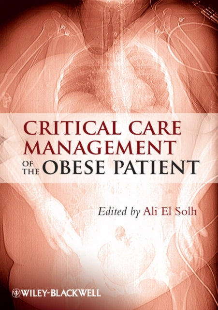 Book cover of: Critical Care Management of the Obese Patient