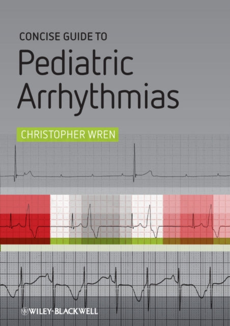 Book cover of: Concise Guide to Pediatric Arrhythmias