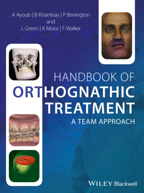 Book cover of: Handbook of Orthognathic Treatment. By: Ashraf Ayoub