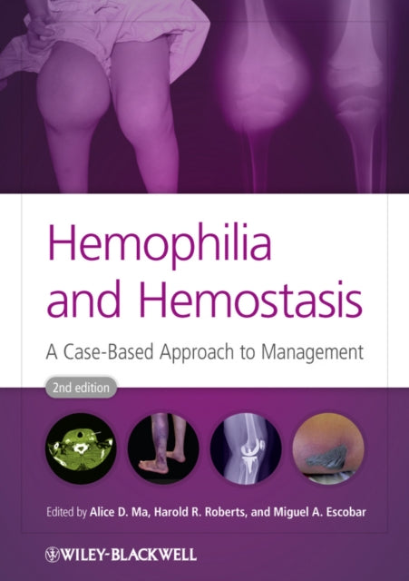 Book cover of: Hemophilia and Hemostasis. By: Alice Ma