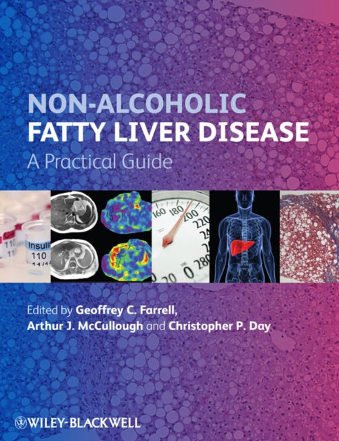 Book cover of: Non-Alcoholic Fatty Liver Disease. By: Geoffrey C. Farrell