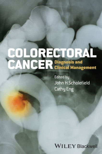 Book cover of: Colorectal Cancer