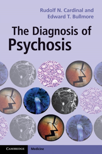 Book cover of: Diagnosis of Psychosis. By: Rudolf N. Cardinal