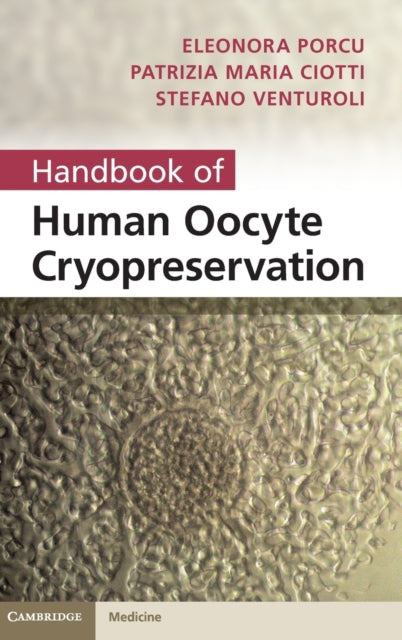 Book cover of: Handbook of Human Oocyte Cryopreservation. By: Eleonora Porcu