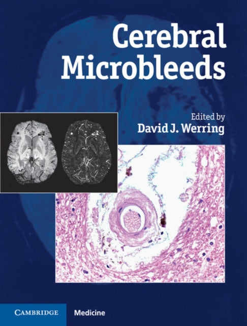 Book cover of: Cerebral Microbleeds. By: David J. Werring