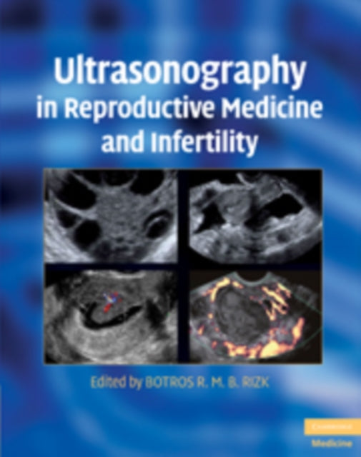 Book cover of: Ultrasonography in Reproductive Medicine and Infertility. By: Botros Rizk