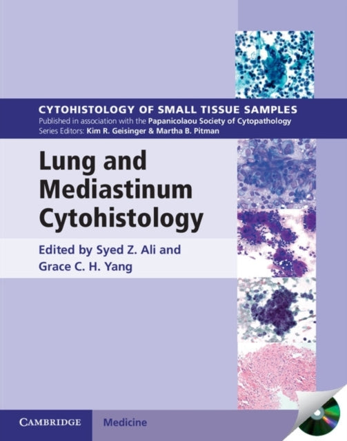 Book cover of: Lung and Mediastinum Cytohistology with CD-ROM. By: Syed Z. Ali