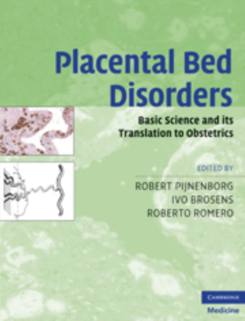 Book cover of: Placental Bed Disorders