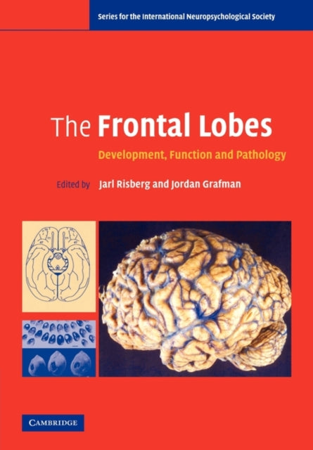 Book cover of: Frontal Lobes