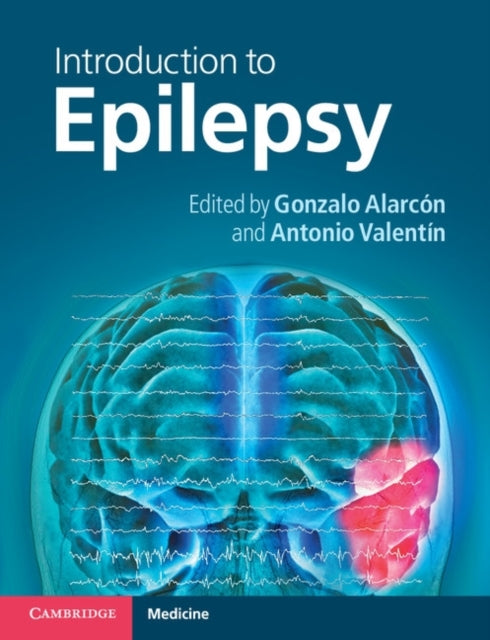 Book cover of: Introduction to Epilepsy