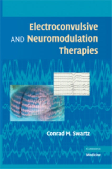 Book cover of: Electroconvulsive and Neuromodulation Therapies