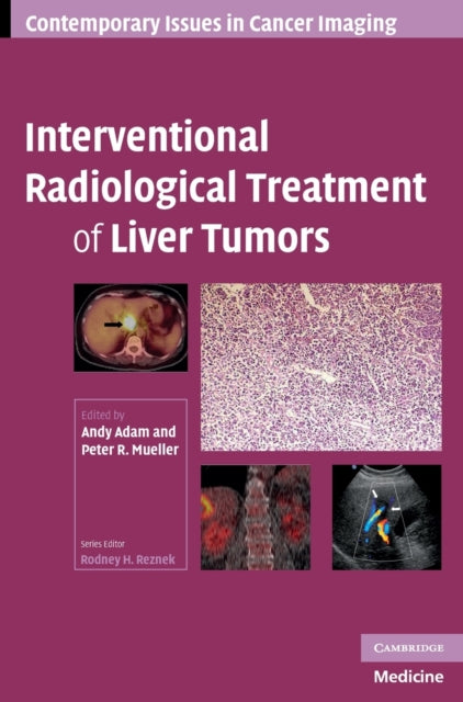 Book cover of: Interventional Radiological Treatment of Liver Tumors