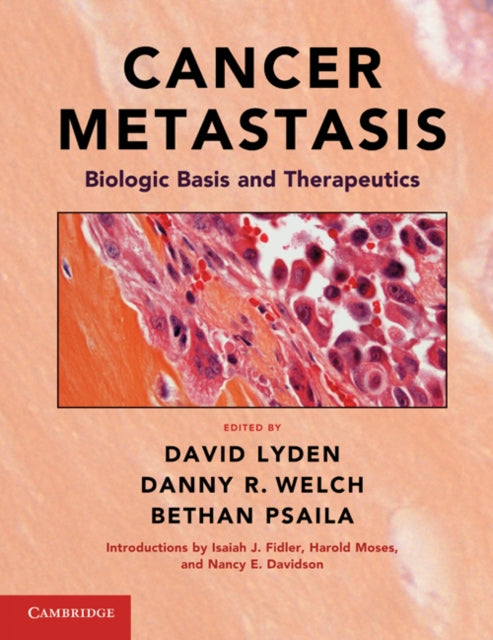 Book cover of: Cancer Metastasis. By: David Lyden