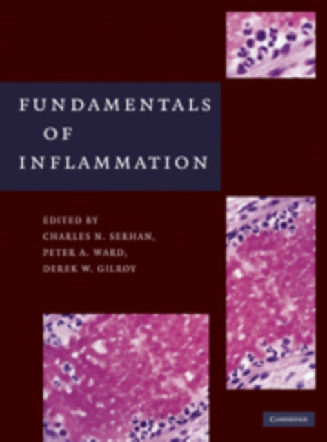 Book cover of: Fundamentals of Inflammation