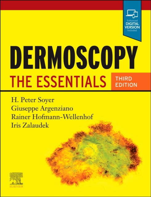 Book cover of: Dermoscopy. By: H. Peter Soyer